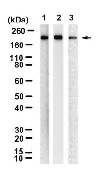 Anti-ACE Antibody, clone 1E15 ZooMAb&#174; Rabbit Monoclonal recombinant, expressed in HEK 293 cells