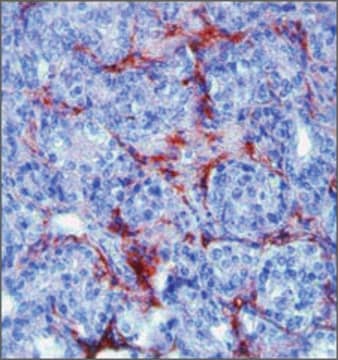 Anti-MMP9 antibody produced in rabbit IgG fraction of antiserum