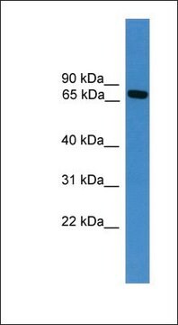 Anti-MASP2 antibody produced in rabbit affinity isolated antibody