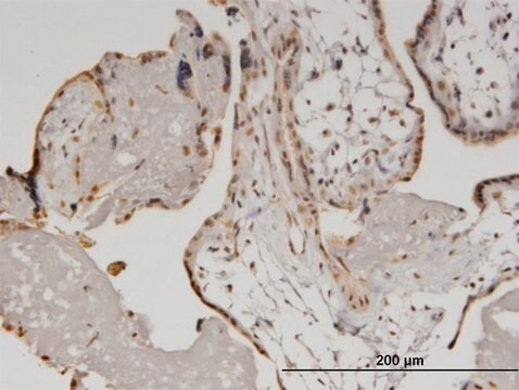 Monoclonal Anti-HELZ, (N-terminal) antibody produced in mouse clone 5B2, purified immunoglobulin, buffered aqueous solution