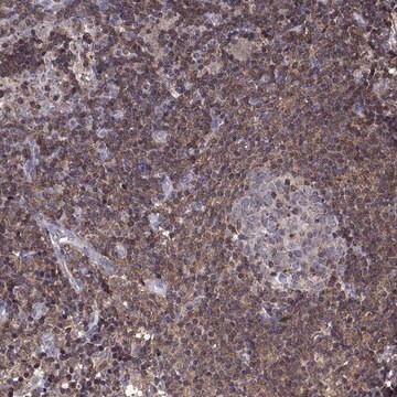 Anti-ACAP1 antibody produced in rabbit Prestige Antibodies&#174; Powered by Atlas Antibodies, affinity isolated antibody