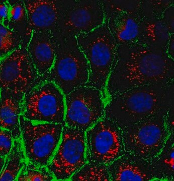 Anticorps anti-alpha-actine, muscle lisse from rabbit, purified by affinity chromatography