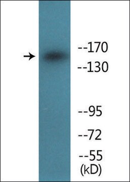 Anti-phospho-IGF1R (pTyr1161) antibody produced in rabbit affinity isolated antibody