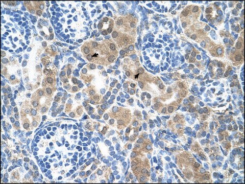 Anti-CBS antibody produced in rabbit IgG fraction of antiserum