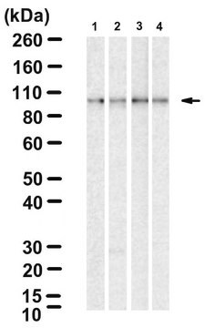 Anti-IKK&#946; Antibody, clone 2N22 ZooMAb&#174; Rabbit Monoclonal recombinant, expressed in HEK 293 cells