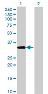 Anti-ACBD4 antibody produced in mouse purified immunoglobulin, buffered aqueous solution