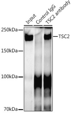 Anti-TSC2 Antibody, clone 7X2C6, Rabbit Monoclonal