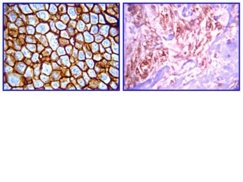 Przeciwciało anty-erbB4, klon HFR1/2G4 clone HFR1/2G4, from mouse