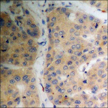 Anti-phospho-SGK (pSer78) antibody produced in rabbit affinity isolated antibody