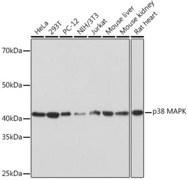 [KO Validated]Anti-p38 MAPK Antibody, clone 8O9O8, Rabbit Monoclonal