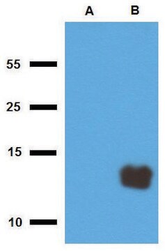 Anti-Tb10.3 (M. tuberculosis) antibody produced in rabbit