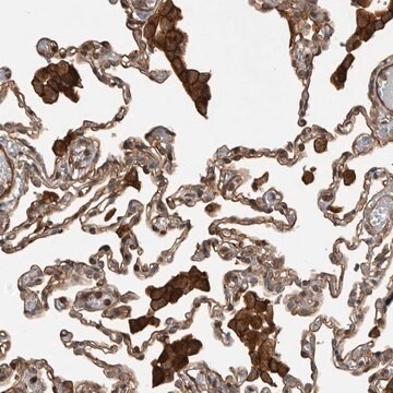 Anti-TRIM56 antibody produced in rabbit Prestige Antibodies&#174; Powered by Atlas Antibodies, affinity isolated antibody, buffered aqueous glycerol solution