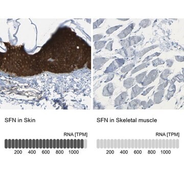 Anti-SFN antibody produced in rabbit Prestige Antibodies&#174; Powered by Atlas Antibodies, affinity isolated antibody, buffered aqueous glycerol solution