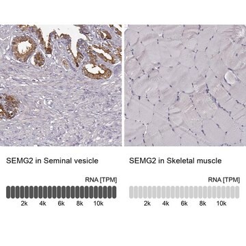 Anti-SEMG2 antibody produced in rabbit Prestige Antibodies&#174; Powered by Atlas Antibodies, affinity isolated antibody, buffered aqueous glycerol solution