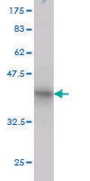 抗-RHOT1单克隆抗体 小鼠抗 clone 4H4, purified immunoglobulin, buffered aqueous solution