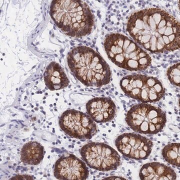 Anti-CKMT1A antibody produced in rabbit Prestige Antibodies&#174; Powered by Atlas Antibodies, affinity isolated antibody, buffered aqueous glycerol solution