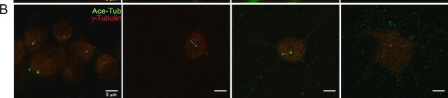 Anti-Tubulin Antibody, Detyrosinated Chemicon&#174;, from rabbit