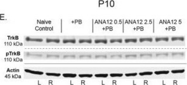 抗リン酸化TrkB (Tyr816)抗体 from rabbit, purified by affinity chromatography