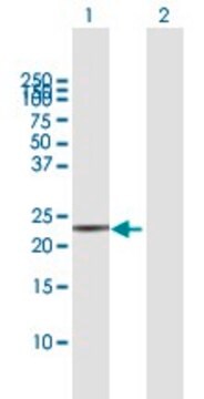 Anti-TAGLN antibody produced in mouse purified immunoglobulin, buffered aqueous solution