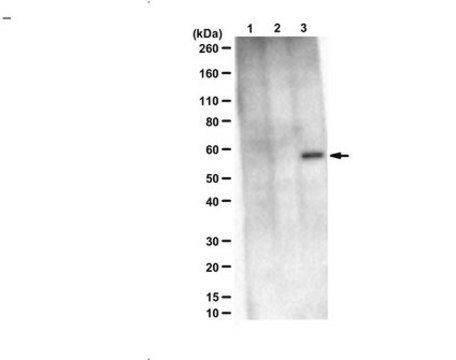 Anti-phospho-PANX1 (Tyr198) from rabbit