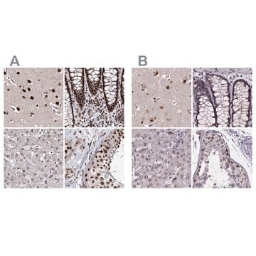 Anti-U2SURP antibody produced in rabbit Prestige Antibodies&#174; Powered by Atlas Antibodies, affinity isolated antibody