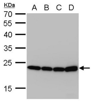 Monoclonal Anti-SOD2 antibody produced in mouse clone GT582, affinity isolated antibody