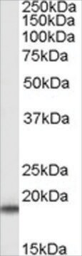 抗SOD1 ヤギ宿主抗体 affinity isolated antibody, buffered aqueous solution