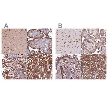 Anti-QARS antibody produced in rabbit Prestige Antibodies&#174; Powered by Atlas Antibodies, affinity isolated antibody, buffered aqueous glycerol solution