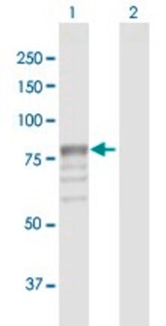 Anti-GUSB antibody produced in rabbit purified immunoglobulin, buffered aqueous solution