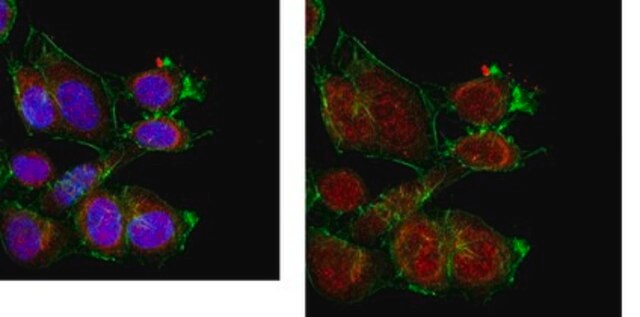 Anti-Peroxiredoxin 1 from rabbit, purified by affinity chromatography