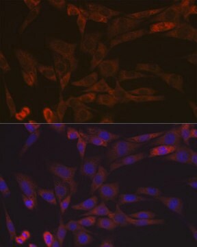 Anti-Inhibin beta A (INHBA) Antibody, clone 1X6N9, Rabbit Monoclonal