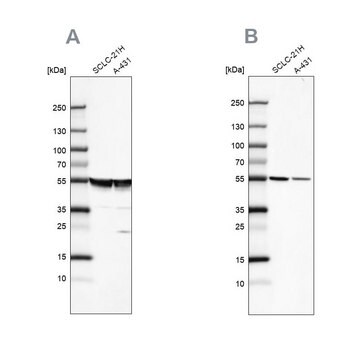 Anty-TUBA1A Prestige Antibodies&#174; Powered by Atlas Antibodies, affinity isolated antibody, buffered aqueous glycerol solution