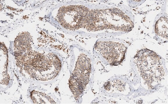 抗&#946;チューブリン抗体 クローン10G11 ZooMAb&#174;ウサギ・モノクローナル recombinant, expressed in HEK 293 cells