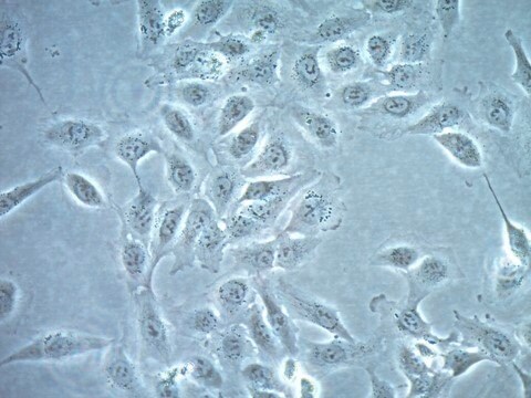 Línea celular del carcinoma de tiroides papilar humano TPC-1 TPC-1 human papillary thyroid carcinoma cell line is a highly characterized model for thyroid cancer research.