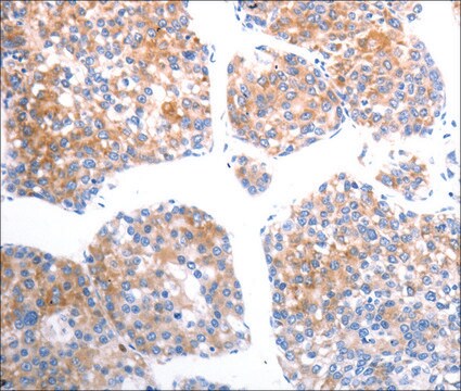 Anty-SLC44A1 affinity isolated antibody