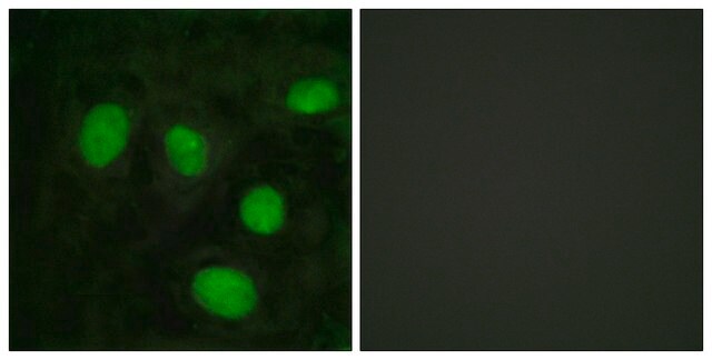 Anti-Histone H1 antibody produced in rabbit affinity isolated antibody