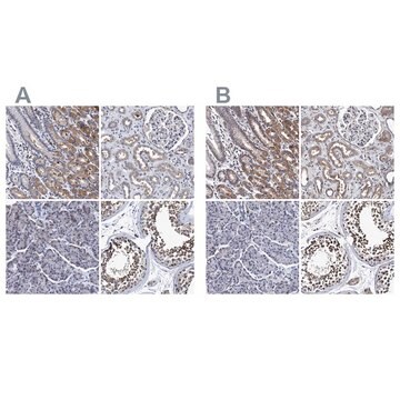 Anti-CALCOCO2 antibody produced in rabbit Prestige Antibodies&#174; Powered by Atlas Antibodies, affinity isolated antibody, buffered aqueous glycerol solution, Ab2