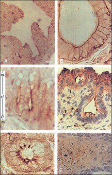 Monoclonal Anti-Phosphotyrosine aus mouse clone PT-66, ascites fluid