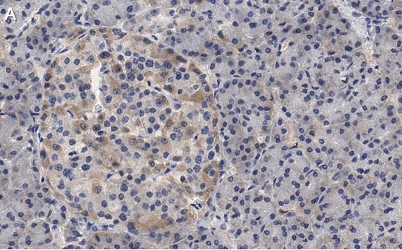 Anti-Helicase MOV-10 Antibody, clone 3B8 ZooMAb&#174; Rabbit Monoclonal recombinant, expressed in HEK 293 cells