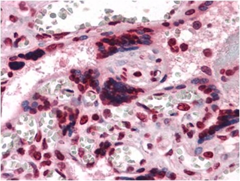 Anti-CSF1-Antikörper, Klon&nbsp;2D10 ascites fluid, clone 2D10, from mouse