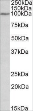 Anti-DAB2 antibody produced in goat affinity isolated antibody, buffered aqueous solution