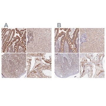 抗MAVS抗体 ウサギ宿主抗体 Prestige Antibodies&#174; Powered by Atlas Antibodies, affinity isolated antibody, buffered aqueous glycerol solution