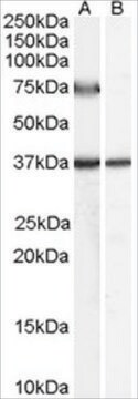 Anti-ACOX2 (AB2) antibody produced in goat affinity isolated antibody, buffered aqueous solution