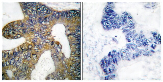 Anti-HSP105 antibody produced in rabbit affinity isolated antibody