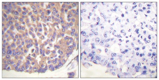 Anti-Filamin A antibody produced in rabbit affinity isolated antibody