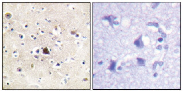 Anti-GR antibody produced in rabbit affinity isolated antibody