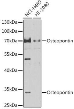 Anti-Osteopontin antibody produced in rabbit