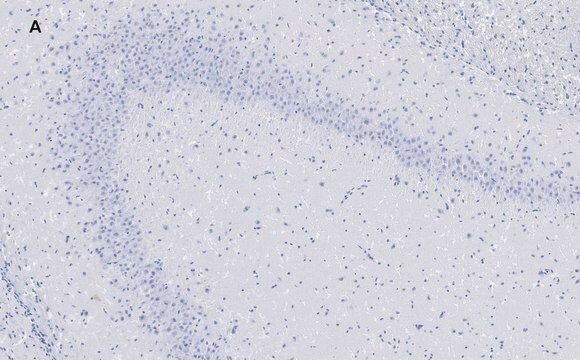 抗GluR2抗体 クローン1K4 ZooMAb&#174;ウサギモノクローナル recombinant, expressed in HEK 293 cells