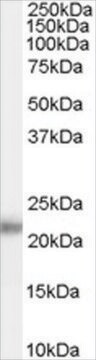 抗KLK2抗体 ヤギ宿主抗体 affinity isolated antibody, buffered aqueous solution