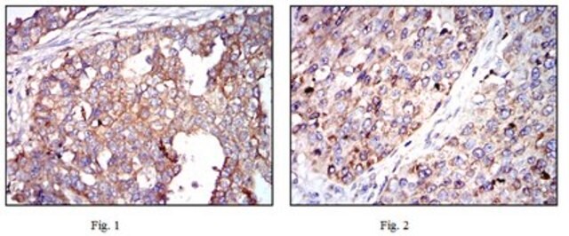 Przeciwciało anty-G6PD, klon 2H7 ascites fluid, clone 2H7, from mouse